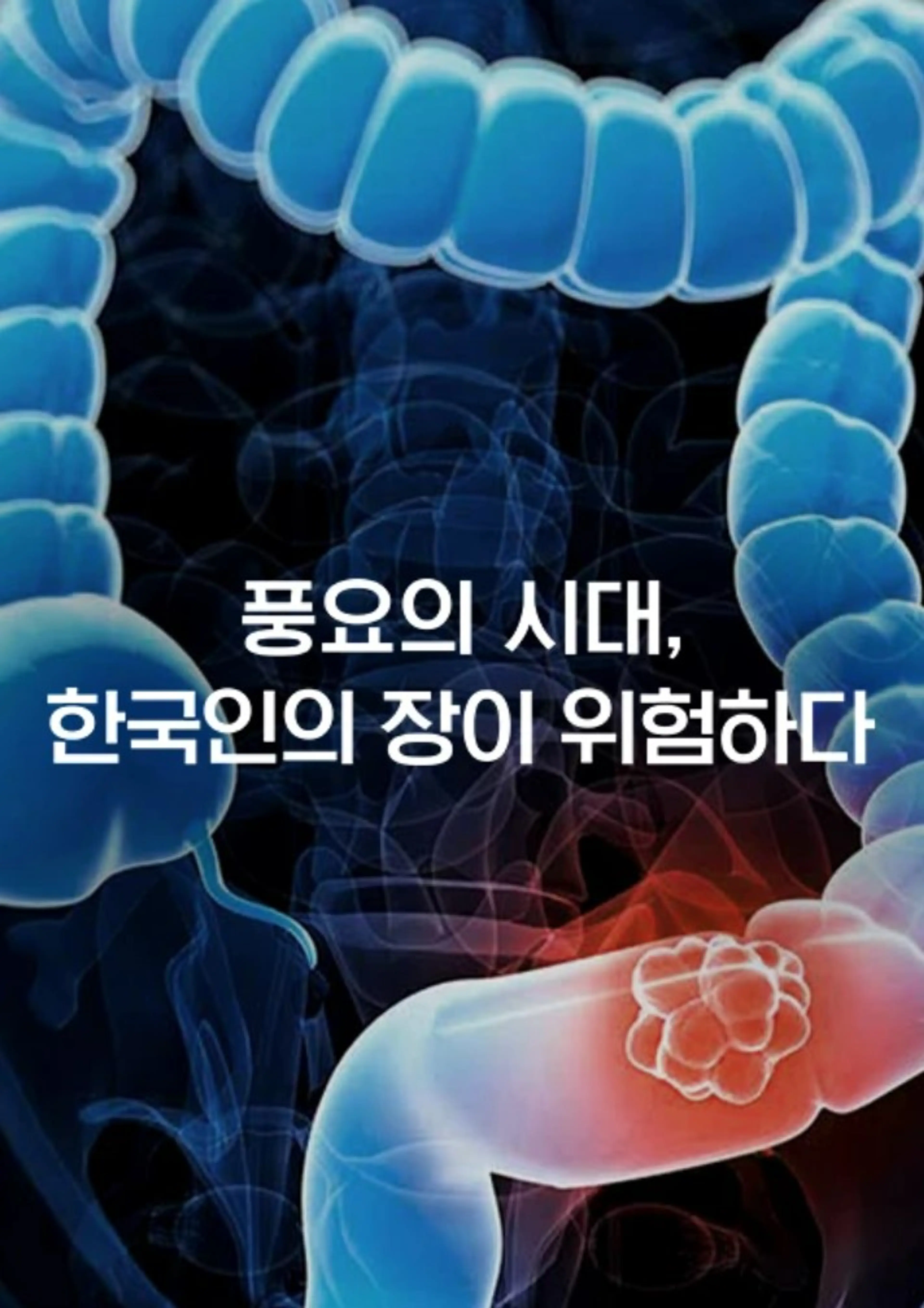 특별기획 풍요의 시대, 한국인의 장이 위험하다